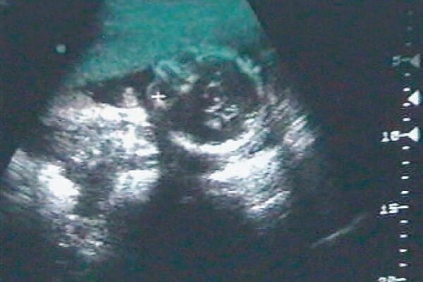 10-échographie_high